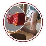 Peripheral Artery Treatment