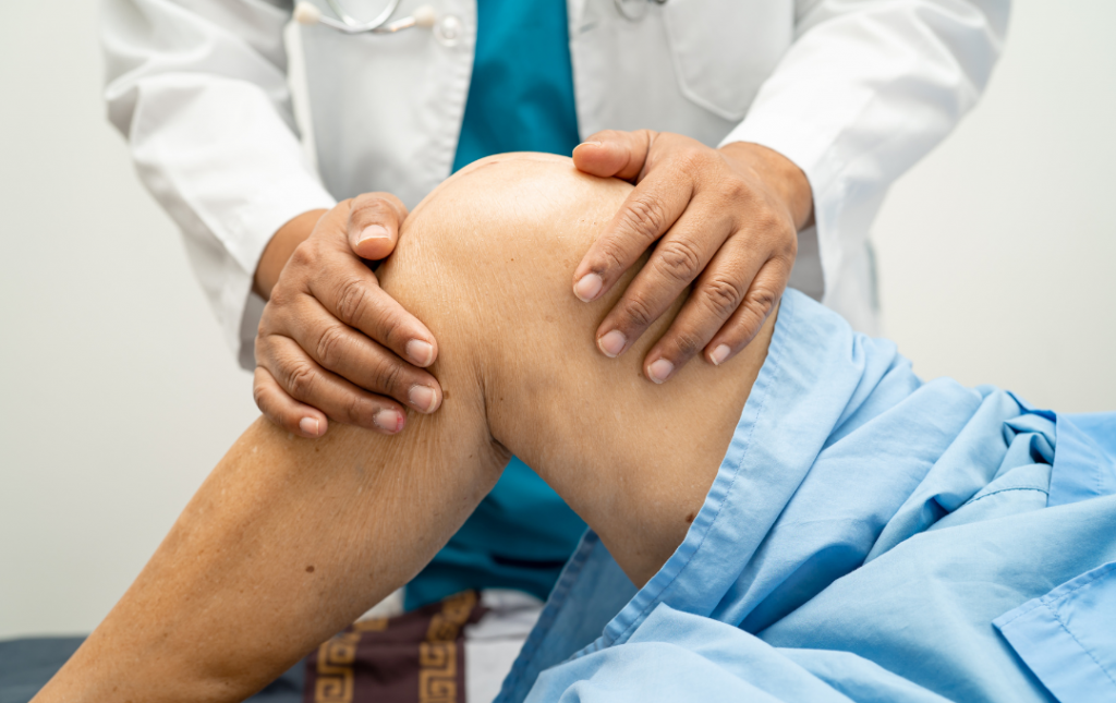 Doctor deciding if you need an X ray for knee arthritis