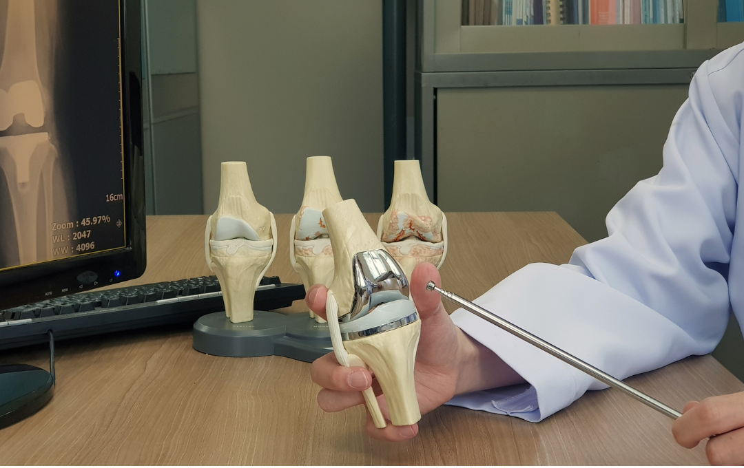 knee replacement surgery