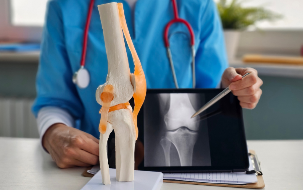 GAE after partial knee replacement